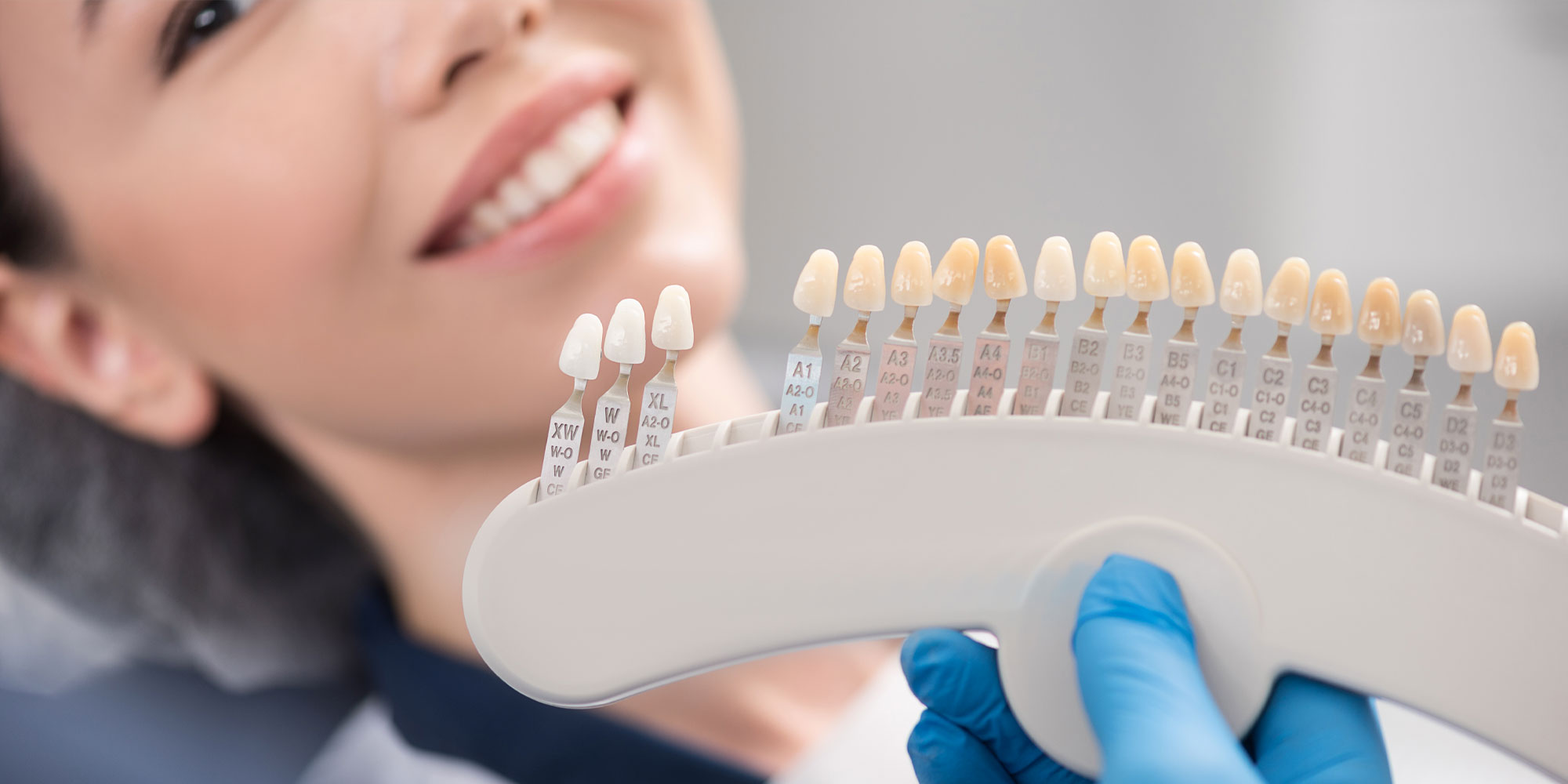 veneer being choosen to match patients teeth